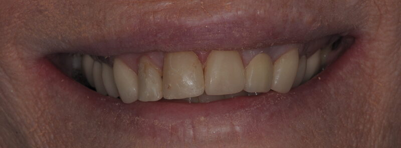 3 after