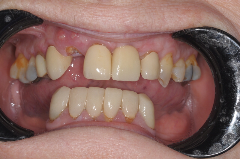 3.before
