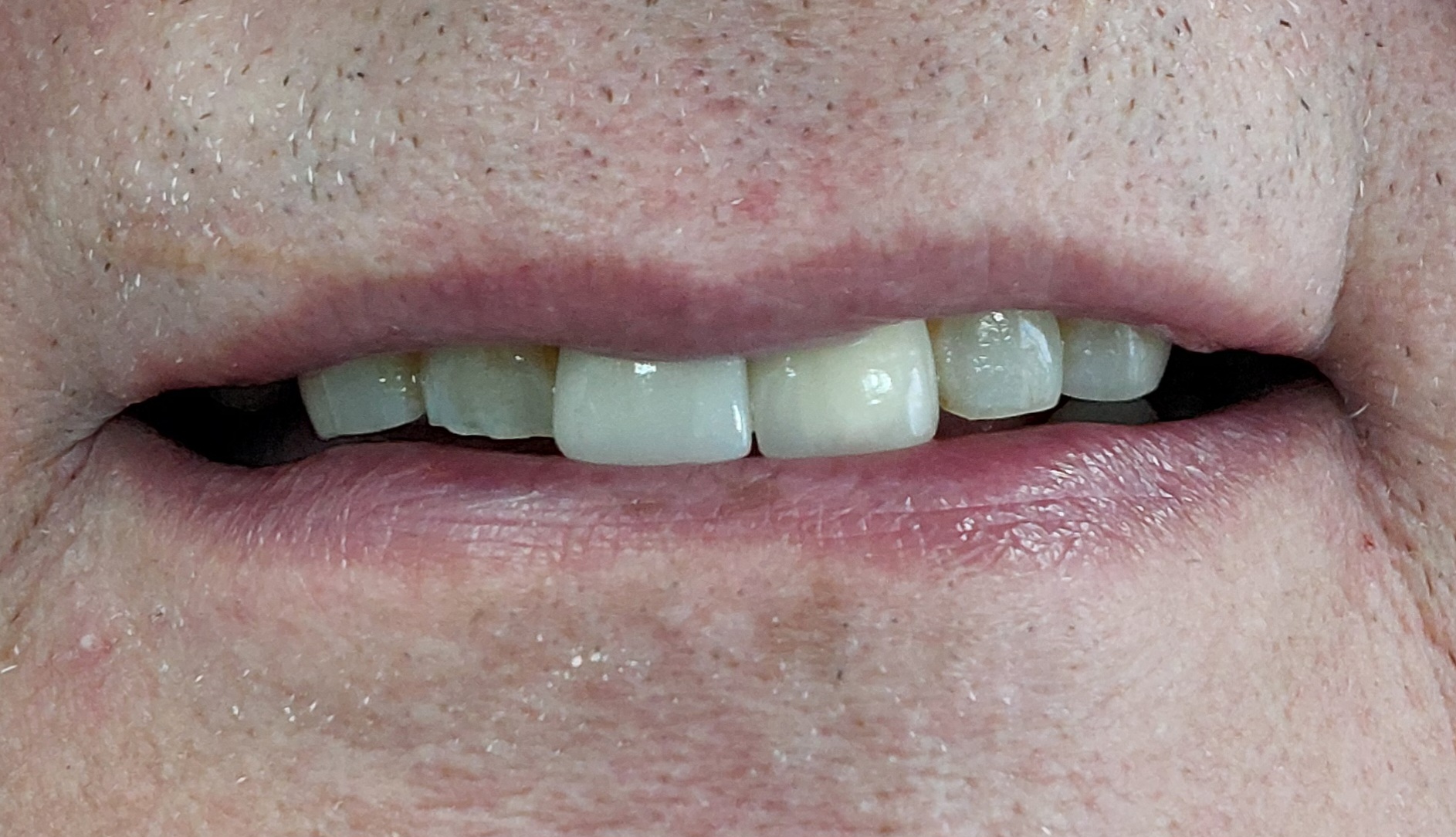 6after