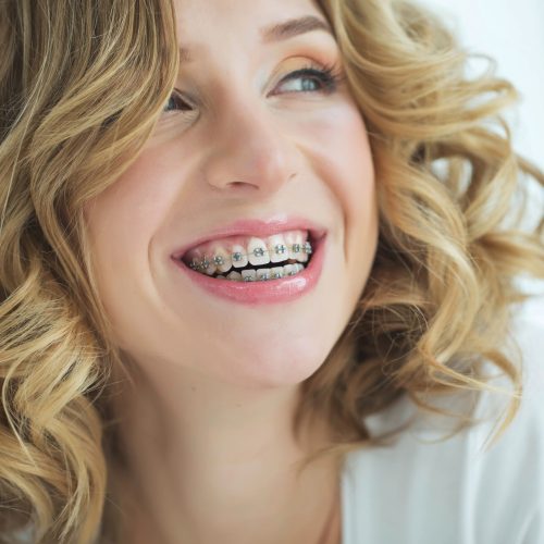 Woman in braces
